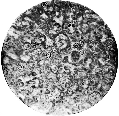 Фото 4. Клетки ('криптококки') гриба Histoplasma farciminosum в гное от больной лошади. Препарат в 50% глицерине. X 1000. Ориг