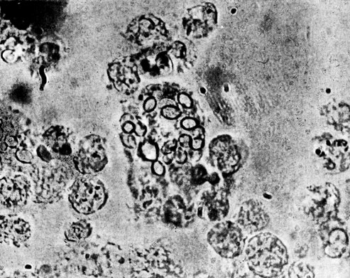 Фото 5. Клетки ('криптококки') гриба Histoplasma jarciminosumj зафагоцитированные макрофагом, в гное от больной лошади. Препарат в 50% глицерине. X 1000. Ориг