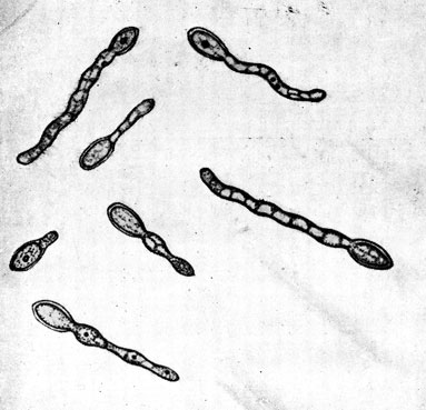 Фото 7. Прорастание клеток ('криптококков') гриба Histoplasma farciminosum с образованием мицелиальных ростков на пятые сутки. Посев гноя на печеночном агаре. х 1200. Рисунок Королевой. Ориг