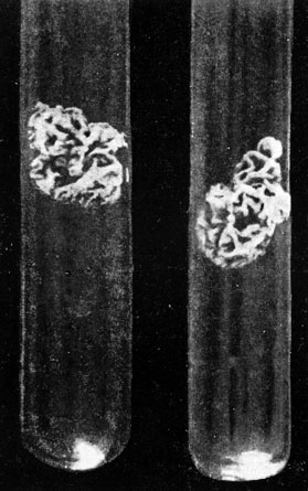 Фото 9. Типичная двухнедельная культура Histoplasma farciminosum на мясопептонно-глицериновом агаре (МПГА) с 2% глюкозы. Колонии неправильно складчатые, желтовато-коричневого цвета, восковидные. Рост при 28-30° Ц. Натуральная величина. Ориг