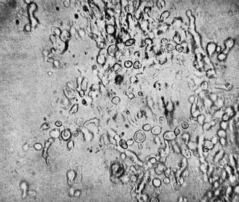 Фото 12. Округлые, бесцветные с двуконтурной оболочкой хламидоспоры Histoplasma farciminosum. Препарат в 50% глицерине из 21/2-месячной культуры гриба на МПГА с 2% глюкозы. х 400. Ориг