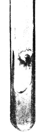 Фото 28. Полуторамесячная культура Trichophyton favijorme на агаре Сабуро. Колония пуговчатая, кожистая, с глубинным ростом в питательную среду. Натуральная величина. Ориг