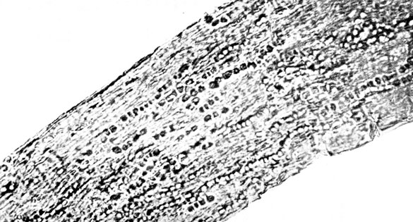 Фото 30. Микроскопия волоса коровы, больной стригущим лишаем. Внутри волоса видна цепочка спор Trichophyton endothrix. Препарат в 20% едком натре. X 400. Ориг