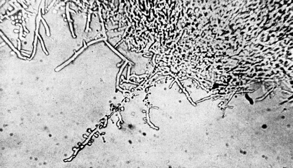Фото 37. Одиночные алейроспоры, сидящие на мицелии Trichophyton gypseum asteroides. Четырехдневная культура гриба на сусло-агаре. X 400. Ориг