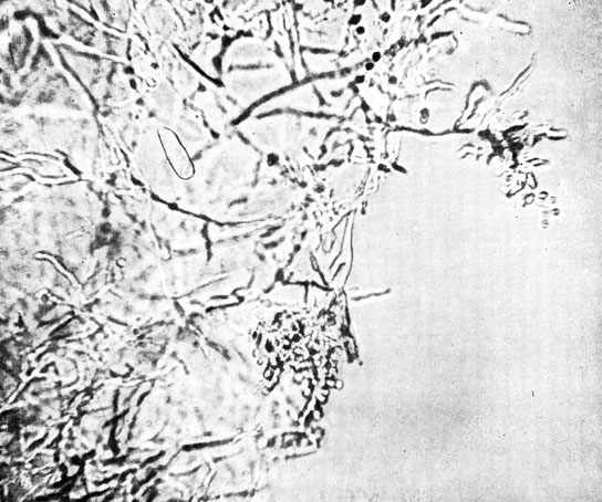 Фото 39. Гроздьевидные скопления алейроспор Trichophyton gypseum asteroides на концах разветвленных нитей мицелия. Шестидневная культура гриба на МПГА с 2% глюкозы. Препарат в 50% глицерине. X 400. Ориг