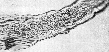 Фото 42. Волос кошки, пораженный Microsporum lanosum. Споры гриба расположены мозаично на поверхности волоса. X 400. Ориг