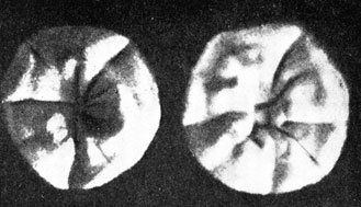 Фото 52. Месячная культура Achoriоп gallinae на глюкозном агаре. Колонии розовые, к центру возвышающиеся, с радиальными складками. Борозды разделяют колонию на сектора неправильной формы. Рост при 30° Ц. Натуральная величина. По Сабуро