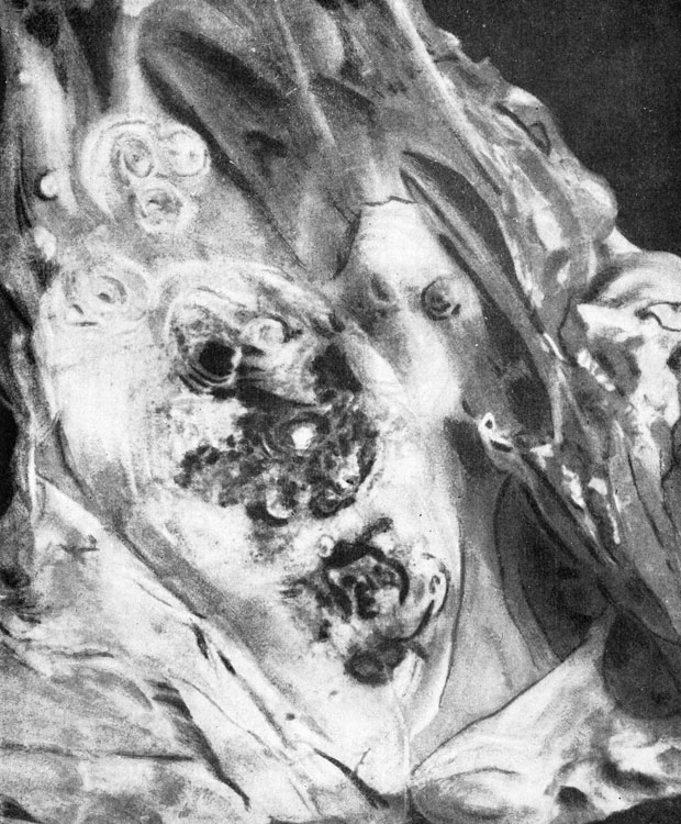 Фото 59. Колонии Aspergillus fumigatus беловатые, хрящеватые, концентрические, в виде дисков, расположенные на серозной оболочке воздухоносного мешка птицы. Часть их покрыта черно-зеленоватыми дерновинками спороношений гриба. Натуральная величина. Ориг