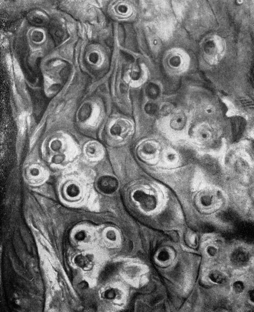 Фото 60. Множественные, беловатые, пуговчато-округлые, концентрические колонии Aspergillus fumigatus на серозной оболочке воздухоносного мешка птицы. Натуральная величина. Ориг