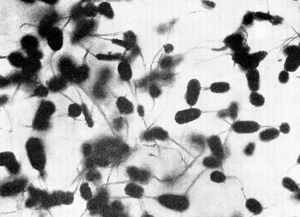 Фото 62. Общий вид спороношения Aspergillus fumigatus в чашке Петри. Масса черно-зеленых, удлиненных споровых головок (длина 85-150, ширина 40-50), представляющих собой плотные колонки цепочек конидий, отходящих от конидиеносцев. X 100. Ориг