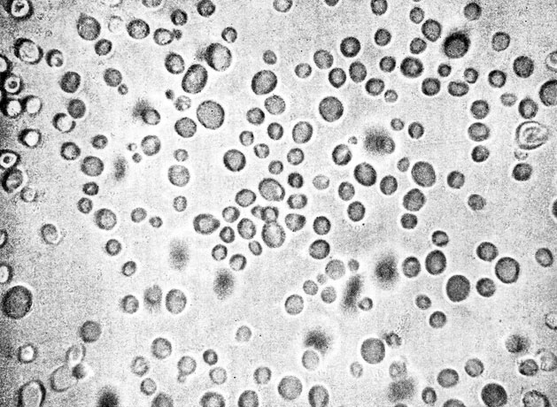 Фото 74. Бесцветные, круглые или овальные клетки Candida albicans из восьмидневной культуры на агаре Сабуро. Клетки большей частью 2,5-3 в диаметре. Внизу слева - почкующиеся клетки. Рост при 28-30° Ц. Препарат в капле воды. х 1000. Ориг