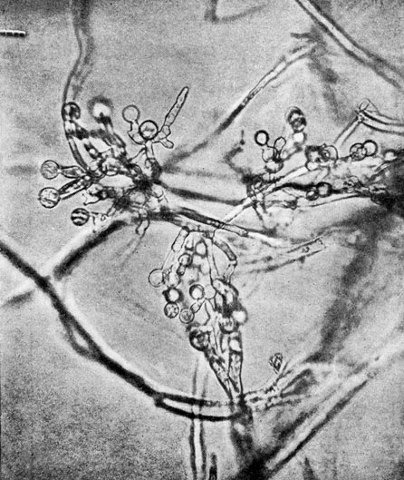Фото 98. Микроконидии Fusarium sporotrichioides, образовавшиеся на концах простых или вильчато-разветвленных конидиеносцев в воздушной грибнице. Десятидневная культура на картофельном агаре. Рост при 20-22° Ц. Препарат в капле воды. х 600. Ориг
