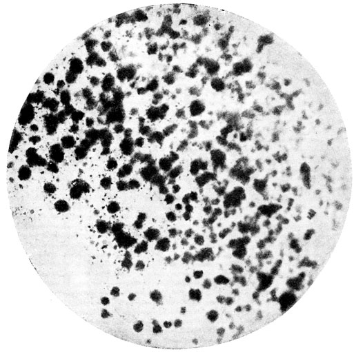 Фото 100. Подушечки спородохий Fusarium sporotrichioides. Двухнедельная культура на картофельном агаре. Рост при 20-22° Ц. Снято в проходящем свете. X 7. Ориг