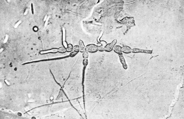 Фото 104. Цепочки округлых хламидоспор Fusarium sporotrichioides. Двухнедельная культура на картофельном агаре. Рост при 20-22° Ц. Препарат в капле воды. X 400. Ориг