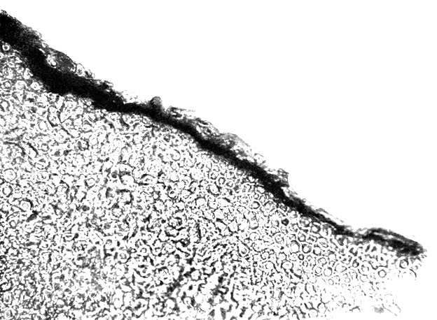 Фото 131. Поперечный разрез склероция Claviceps purpurea. По периферии темный корковый слой. Внутри светлая ткань, состоящая из тесно переплетающихся мицелиальных нитей. X 100. Ориг