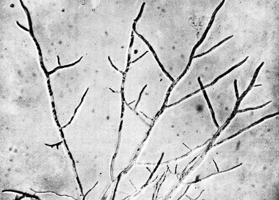 Фото 172. Одноклеточный мицелий Mucor racemosus. Просмотр края трехдневной колонии на агаре Чапека. Препарат в 50% глицерине. х 100. Ориг