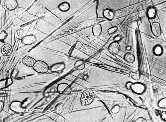 Фото 176. Хламидоспоры Mucor racemosus, длиной 20-30, шириной 11-20, образовавшиеся сегментацией мицелия. Шестидневная культура на агаре Чапека. Препарат в 50% глицерине. X 400. Ориг