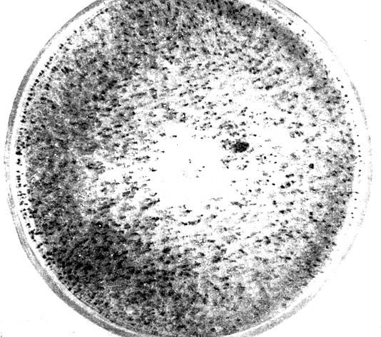 Фото 191. Двадцатидневная культура Chaetomium pannosum Wallr. на агаре Чапека. Масса черно-оливковых овальных перитециев высотой до 1/2 мм, шириной 1/3 мм, с капельками жидкости. Рост при 24-26° Ц. Натуральная величина. Ориг