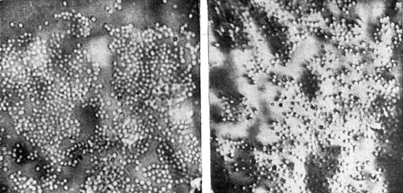 Фото 249. Мицелий Actinomyces sp., распавшийся на круглые мелкие споры. Препарат двухмесячной культуры гриба на МПГА с 2% глюкозы. X 1000. Ориг