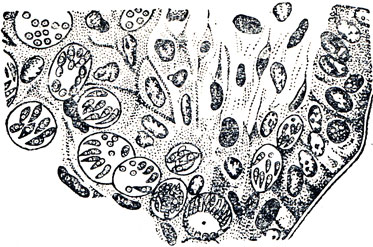 Рис. 22. Кокцидии в разных стадиях развития в эпителиальных клетках кишечника (срез кишечника)