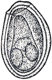 Рис. 28. Яйцо D. lanceatum (по К. И. Скрябину и Р. С. Шульцу)