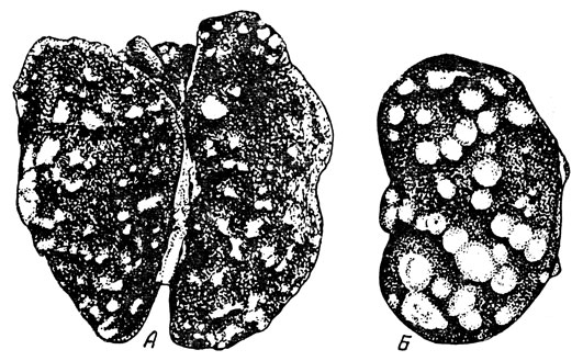 Рис. 65. Поражение легких (А) и почек (Б) кролика при туберкулезе
