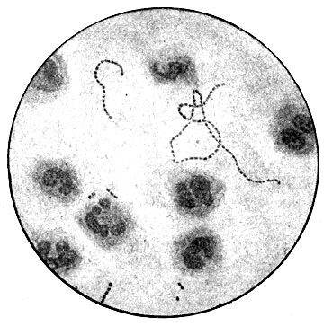 . 109. Streptococcus equi     